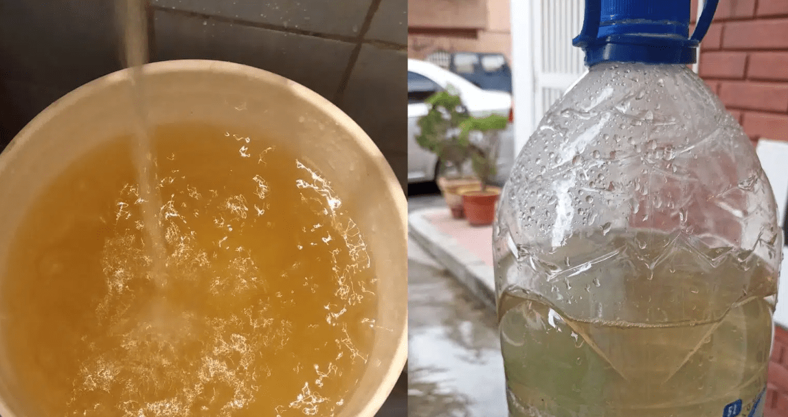 Agua de mala calidad en Caracas cuáles son los riesgos para la salud