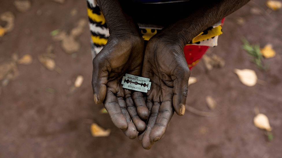 Mutilación genital femenina